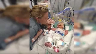 Baby Born Dead At 5 Months, 8 Minutes Later Doctors Are Shocked By Miracle