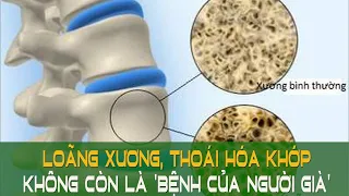 Loãng xương, thoái hóa khớp không còn là 'bệnh của người già'  | Sức khỏe vàng VTC16