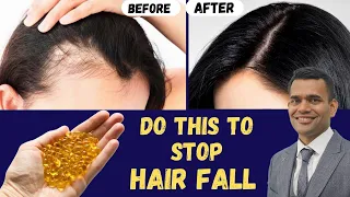 Prevent Hair Fall And Regrow Your Hair | Dr. Vivek Joshi