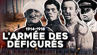 La Tragique histoire des Gueules Cassées