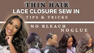New 2024 Method | Thin Hair Lace Closure Protective Tips and Tricks - Dome Cap Method