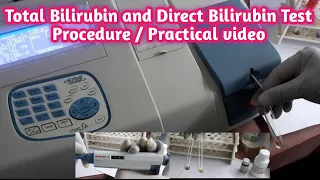 Total Bilirubin and Direct Bilirubin Test Procedure Practical Video