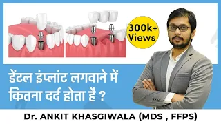 क्या डेंटल इंप्लांट लगवाने में दर्द होता है? Is Dental Implant process painful? Dr. Ankit Khasgiwala