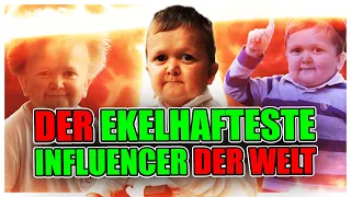 Hasbulla - Einer der ekelhaftesten Influencer der Welt