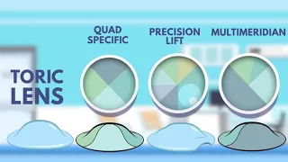 Scleral Contact Lenses for Keratoconus and Hard to fit Eyes