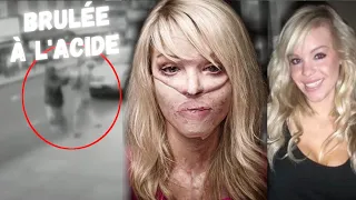 Katie Piper : Mannequin et animatrice, elle tombe dans un piège et sera défigurée à l'acide !