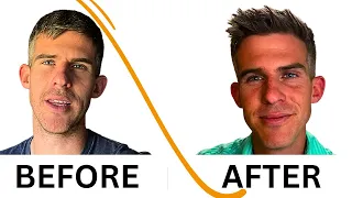 TMS Therapy Before and After - Jordan Bryant 31