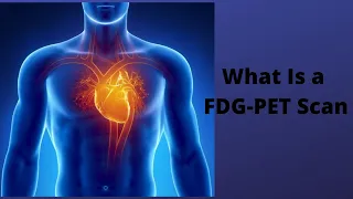 What Is a FDG PET Scan