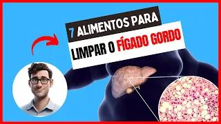 🔴Desintoxique Seu Corpo: Os 7 Melhores Alimentos para Limpar o Fígado Gordo-Como limpar o figado