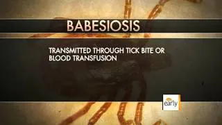 Babesiosis: Illness ticks spread on the rise