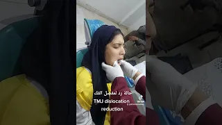 حالة رد لمفصل الفك TMJ dislocation reduction