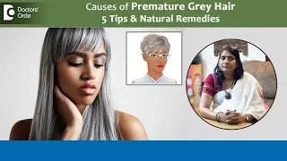 5 Tips & Natural Remedies-Premature Grey Hair| Early greying Cause-Dr.Surekha Tiwari|Doctors' Circle