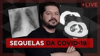 Live 02/10 - As sequelas da COVID