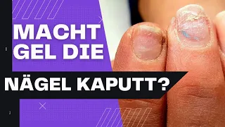 NAILHACK: stark beschädigte Nägel wieder herstellen