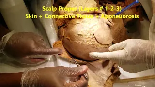 Scalp Layers and Neurovascular Demonstration  - Special Reference to Common Ailments – Sanjoy Sanyal