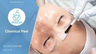 Chemical Peel in Turkey (15) Minutes - Turk Aesthetic