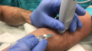 Ultrasound Guided Peripheral IV Insertion - "In-plane" Approach
