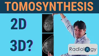 Tomosynthesis (Does it offer 3D Mammography)