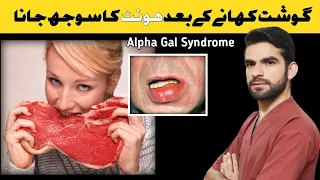 Swollen lips after eating meat || Meat Allergy || Alpha Gal Syndrome