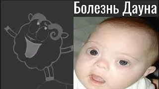 Наследственные болезни ...