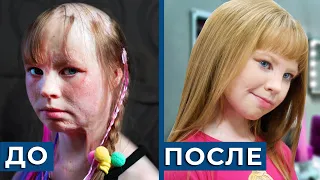 После ПОЖАРА в КРАСАВИЦУ, преображение ДО и ПОСЛЕ / новая жизнь Алеси