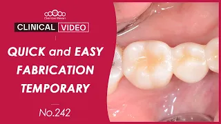 Quick and Easy fabrication of Temporary crown - [Dr. Na Kiwon]