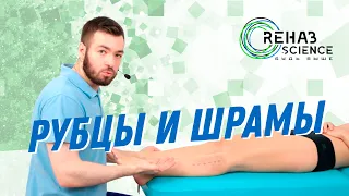 ИММТ: Работа с рубцами и шрамами