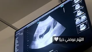 بداية يوم لطيفة 🤍وبنهاية اليوم خبر صادم 💔