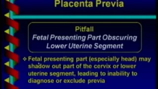 Placenta, Cord and Fluid