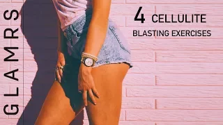 Cellulite Removal Exercises - Get Rid of Cellulite on Butts, Thighs and Legs | No Gym Workout