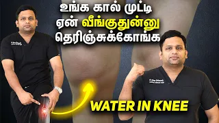 Explains Water in the Knee Dr Shriram krishnamoorthy | Tamil