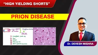 High Yielding Shorts-79 (#HYS-79):Prion Disease by Dr. Devesh Mishra.
