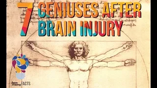 7 People Who Became Geniuses After Brain Injury