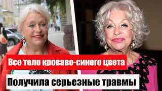 «Все тело кроваво-синего цвета»: Вдова Караченцова получила серьезные травмы