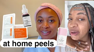 the best of at home chemical peels | safe for dark skin ✨