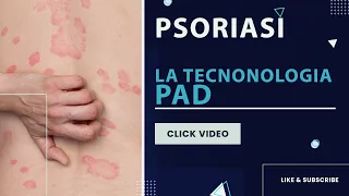 Psoriasi, la tecnonologia PAD