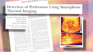 Smart Phone Compatible Thermal Imaging: Plastic Surgery Hot Topics with Rod J. Rohrich, MD