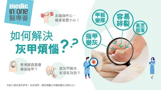 灰甲治療｜灰甲成因逐個捉！哪種灰甲清除方法最有效？