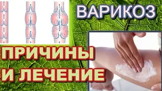 Лечение варикозного расширения вен и причины его появления . Дуйко АА встреча 2018 год май. @Duiko ​