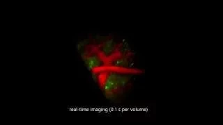 SCAPE real-time 3D microscopy - Intact brain