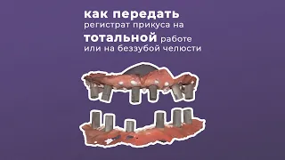 КАК ПЕРЕДАТЬ РЕГИСТРАТ ПРИКУСА НА ТОТАЛЬНОЙ РАБОТЕ ИЛИ НА БЕЗЗУБОЙ ЧЕЛЮСТИ | ARTICON