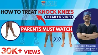 What are Knock Knees?What Causes Knock Knees? How to treat Knock Knees? Dr.Tejas Upasani (In Hindi)