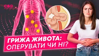 Грижа живота (грижа черевної стінки): оперувати чи ні?