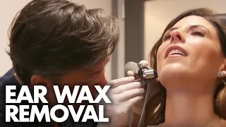 MEDICAL EAR WAX EXTRACTION (Beauty Trippin)