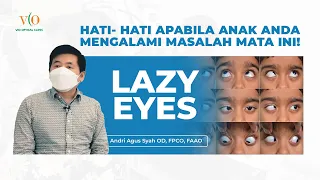 PEMERIKSAAN MATA MALAS ANAK (LAZY EYES)- VIO OPTICAL CLINIC