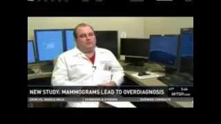 Florida Hospital Tampa experts discuss recent study on mammography