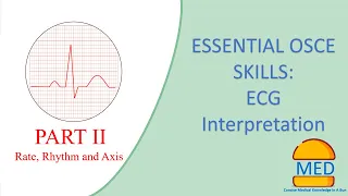 OSCE ESSENTIALS - ECG INTERPRETATION PART 2 (Rate, Rhythm and Axis)