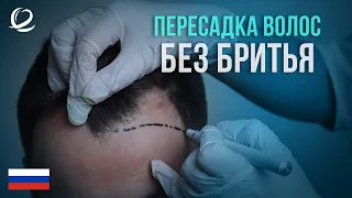 Пересадка волос без бритья | Методы трансплантации волос в Clinicana Стамбул, Турция