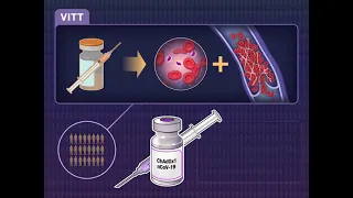 What should know on COVID-19: Vaccine-induced immune thrombotic thrombocytopenia (VITT)