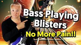 Bass Playing Tips For Avoiding Blisters and Sore Fingers - It's All In The Amp Settings!